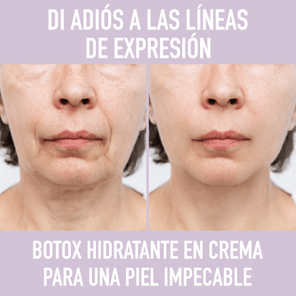 Crema Botox Atiarruga | PAGA AL RECIBIR