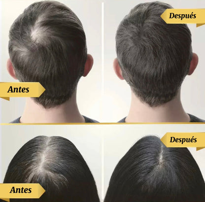 Tónico para el cabello: compre 1 y obtenga 2