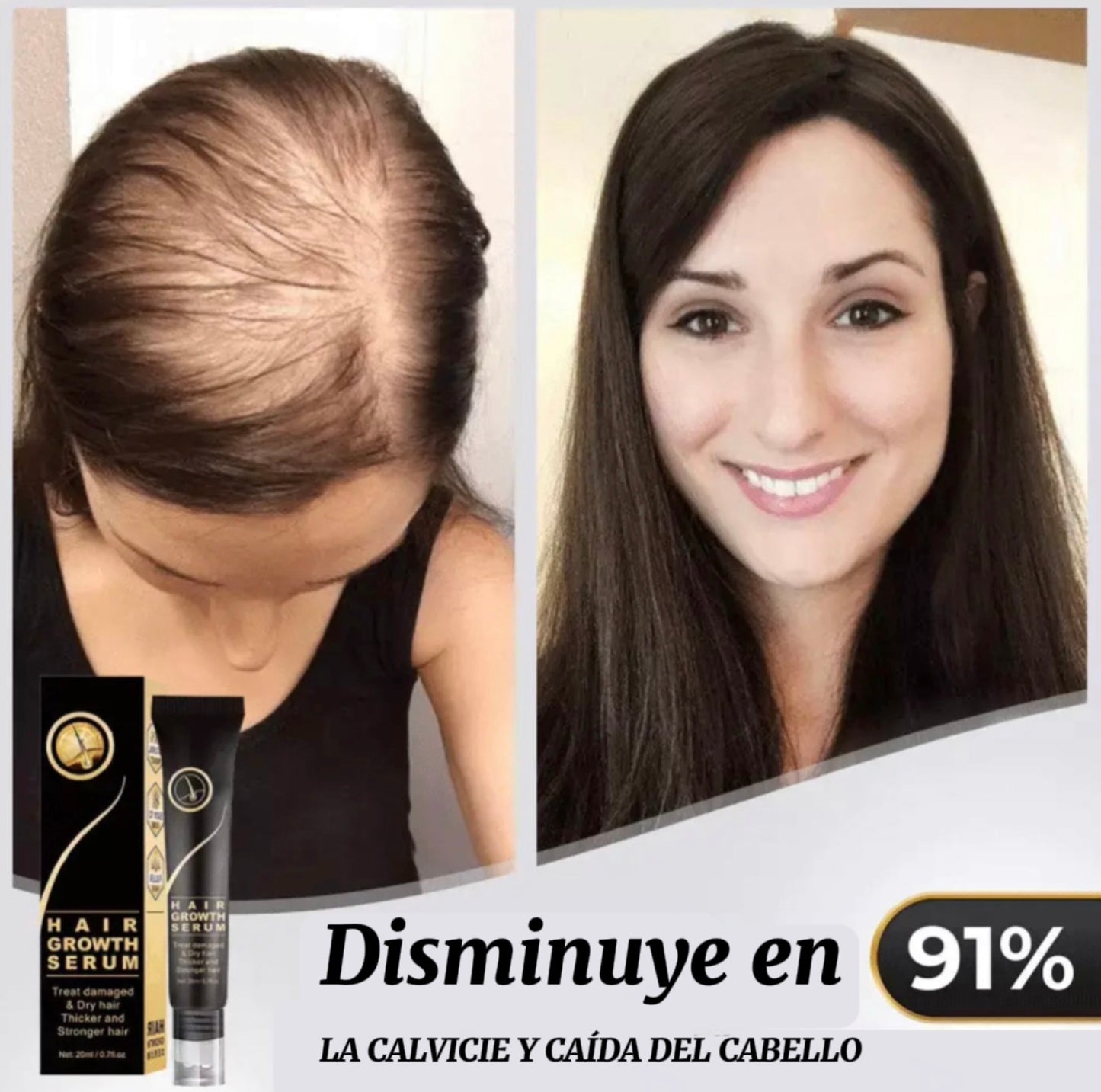 Tónico para el cabello: compre 1 y obtenga 2