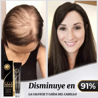 Tónico para el cabello: compre 1 y obtenga 2