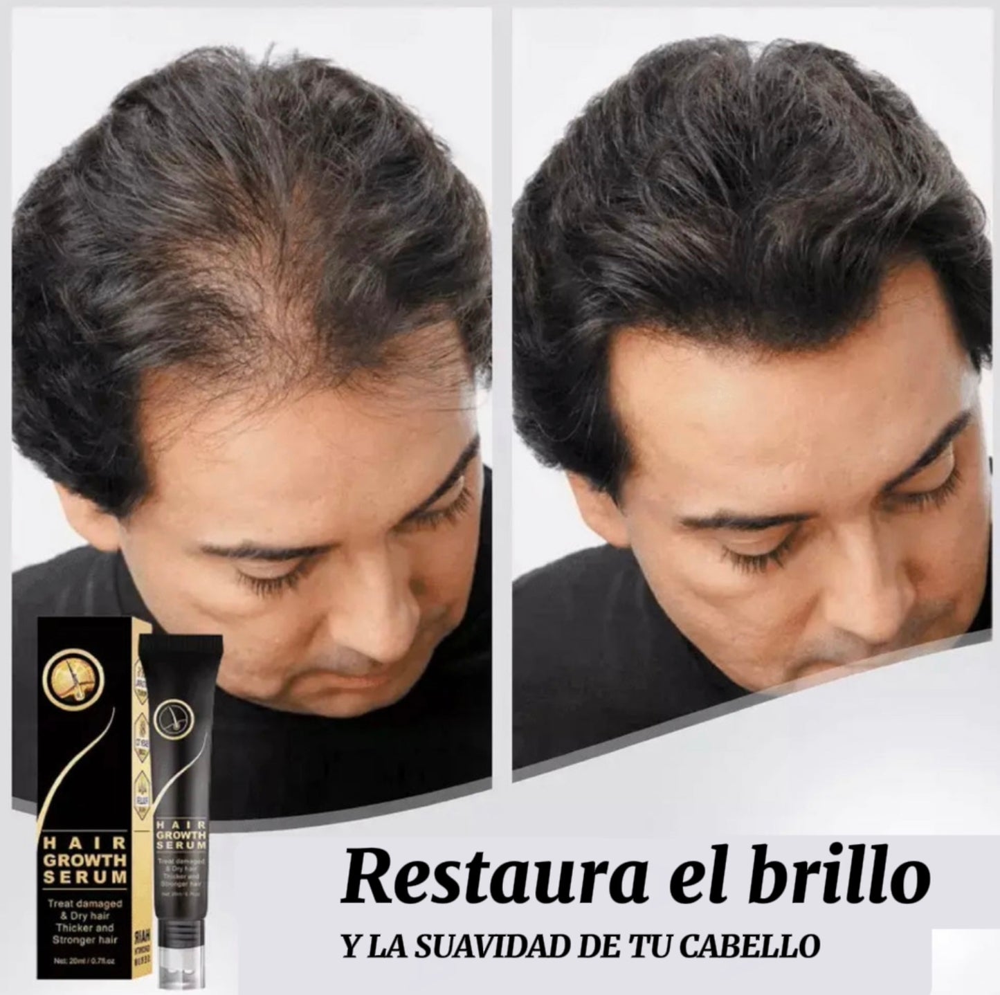 Tónico para el cabello: compre 1 y obtenga 2