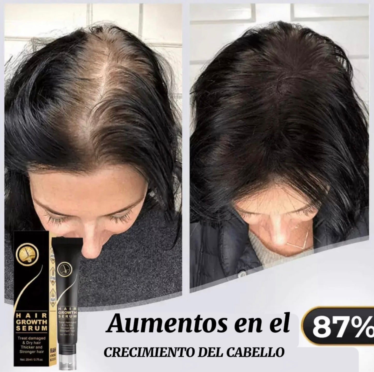 Tónico para el cabello: compre 1 y obtenga 2